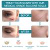 Medical Grade Silicone Scar Sheets, Silicone Scar Tape (1.6x 60), Scar Removal Strips for Acne Scars C-Section & Keloid Surgery Scars Sheets Treatment Sheets - 6-8 Month Supply view 3