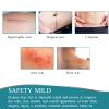 Medical Grade Silicone Scar Sheets, Silicone Scar Tape (1.6x 60), Scar Removal Strips for Acne Scars C-Section & Keloid Surgery Scars Sheets Treatment Sheets - 6-8 Month Supply view 4