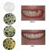 10g Temporary Moldable False Teeth Repair Replacement Thermal Fitting Beads - Instant Confident Smile (Bright White) view 4