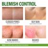Perfect Skin Acne Pills - Clear Skin Supplement with Niacinamide, Probiotic, Zinc & Vitamin A - Anti Acne Vitamins for Teens, Men & Women - Support for Face & Back Acne, Acne Scars - 60 Capsules view 4