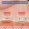 Silicone Scar Sheets for Breast - 8 Pack, Including 4 Areola Soft Strips & 4 Anchor Sheets view 2
