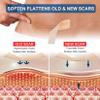 ZODENIS Silicone Scar Tape, Silicone Scar Sheets, Scar Silicone Strips, Easy-Tear Gel Tape For Scar, Scar Remover. view 2