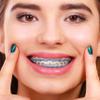 Annhua Orthodontic Braces Rubber Chains, Dental Rubber Chains Power Chains for Braces, Long, Purple - 20# - 15ft/Roll view 3
