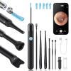 Loyker X6 Ear Wax Removal Tool Camera, Ear Cleaner with Camera, FSA - HSA Store Eligible, 1080P Ear Camera with 6LED Light for Ear/Nose/Throat/Tonsil Stone Examination, Black view 1