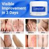 LMNOOP Eczema Cream for Dry, Itchy, Irritated, and Eczema Prone Skin, Maximum Strength Treatment Ointment for Rash, Psoriasis, Dermatitis 3.53oz view 4