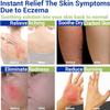 LMNOOP Eczema Cream for Dry, Itchy, Irritated, and Eczema Prone Skin, Maximum Strength Treatment Ointment for Rash, Psoriasis, Dermatitis(7.05oz) view 2
