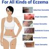 LMNOOP Eczema Cream for Dry, Itchy, Irritated, and Eczema Prone Skin, Maximum Strength Treatment Ointment for Rash, Psoriasis, Dermatitis(7.05oz) view 3