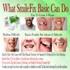 SmileFix Basic Dental Repair - for Missing Or Damaged Teeth - Fix Gaps, Missing Teeth, Spaces, Broken Tooth, Repairs - Fast & Easy - Confident Smiles - BF Products - Durable Compound view 2