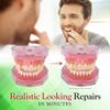 SmileFix Basic Dental Repair - for Missing Or Damaged Teeth - Fix Gaps, Missing Teeth, Spaces, Broken Tooth, Repairs - Fast & Easy - Confident Smiles - BF Products - Durable Compound view 3