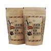 Admart Zizira 9% Curcumin Lakadong Turmeric Powder -300 g view 1
