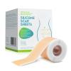 Silicone Scar Sheets, Silicone Scar Tape Roll, Scar Removal Sheet Long Strips for Acne Burn, Keloid (1.6 x 60) view 1