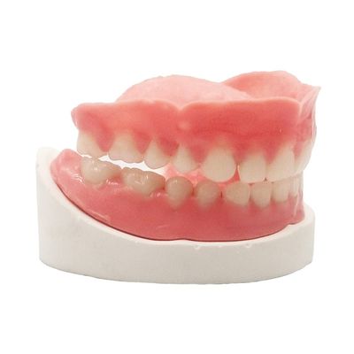 Denture Do it Yourself Full Set of Top and Bottom Fake Teeth for Improve Your Smile (Gypsum Model Gum Material and Fake Teeth)