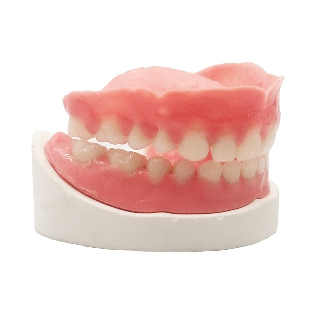 Denture Do it Yourself Full Set of Top and Bottom Fake Teeth for Improve Your Smile (Gypsum Model Gum Material and Fake Teeth)