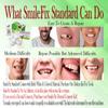 SmileFix Standard Dental Repair Kit - Color Matching Compound - For Missing Or Damaged Teeth - Fix Gaps, Broken Tooth, Spaces - Durable Repair - Fast & Easy - Confident Smiles view 2