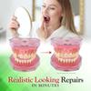 SmileFix Standard Dental Repair Kit - Color Matching Compound - For Missing Or Damaged Teeth - Fix Gaps, Broken Tooth, Spaces - Durable Repair - Fast & Easy - Confident Smiles view 3