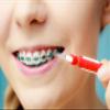 Interdental Proxy Brush Go-Betweens Interdental Brushes, Angle Cleaner, Tight - Assorted Size, Vivid NovoClean - Pack of 40 view 4