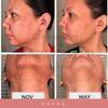 Elizkof Beauty Store Diamond Glow Skin Supplement for Whitening & Skin Glowing view 2