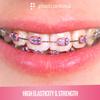 2080 Gray Ligature Ties for Braces - Dental Orthodontic Ligature Ties for Brackets - Elastic O-Ring Rubber Bands (2 Bags of 1040) view 3