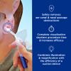 Bionix - Lighted Suction Handles, Earwax Removal Tool, Helps Remove Excess Wax & Round Foreign Objects, Convenient, Easy to Use, Ideal for Healthcare Professionals (25 Count) view 4