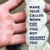 Callus Score, Healing Salve & 2 Smoothers  Ultimate Precision Hand Callus Remover | Prevents Ripping | Smoother for Athletes, Weightlifters & Gym Enthusiasts | Solution for Dry, Rough Hands & Fingers view 4