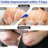 LMNOOP Eczema Cream, Maximum Strength Treatment Ointment for Rash, Psoriasis, Dermatitis, Urticaria, Jock Itch, Fungal Infection, Anti-Itch, Relief for Sensitive, Irritated Skin 1.76oz view 4