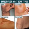 NUVADERMIS Silicone Scar Sheets for Surgical Scars - 120" x 1.5" Roll - Medical Grade Silicone Scar Tape and Face Tape for Wrinkles, Keloid Scars, and Hypertrophic Scars - Reusable - 1 Pack view 4