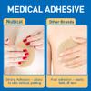 Medical Silicone Scar Sheets 8 Pack, Breast Scar Treatment After Surgery, Post Surgery Supplies Scar Removal SheetsBreast Reduction After Surgery for Scars view 3
