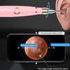 Feilx Earwax Removal Tool with Camera,Portable Multifunctional Ear Cleaner 200 Megapixel HD Ear Wax Removal with Camera,Ear Wax Removal Tool,Ear Cleane view 3