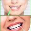 Zopeal 250 Pieces Braces Flossers Interdental Brush for Cleaner Tooth Toothpick Dental Teeth Flossing Picks Head Oral Dental Hygiene Cleaning Tool Soft Cleaners(Fresh Color) view 4