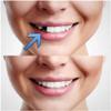 sowsmile Upper and Lower Temporary Missing Teeth Tooth Gap Repair Fix Replacement Solution, Confident Snap on Instant Perfect Smile kit view 4