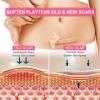 Silicone Scar Sheets, Clear Silicon Gel Scar Sheets, Invisible Scar Tape(1.6 x 120Roll-3M), Scar Strips for Surgical Scars, Medical Grade, Scar Removal Sheets view 3