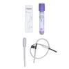 Cow Pregnancy Test, Bovine Cow Rapid Early Pregnancy Test Kit Pregnancy Test Card Livestock Pregnant Testing for Dairy Cow Livestock view 1