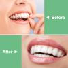 BVN Aligner Chewies, 10 Pieces Orthodontic Chewies, Retainer Chewies, Dental Chewies for Aligners, Orthodontic Dental Chewies Munchies, Green view 4