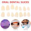 EXCEART 100 Pieces Artificial Resin Teeth Veneer Fillings - Temporary Replacements for Tooth Repair Supply view 4