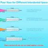 Modacraft 120Pcs Interdental Brush 4 Sizes Braces Brush Toothpicks with Soft Bristles 360 Bendable Floss Heads Dental Brushes Between Teeth Gum Braces Cleaning Kit Oral Tooth Cleaning Tool view 3