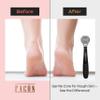 Facn Professional Callus Shaver Remover with 50 Blades, Pedicure Razor for Feet & Hands, Foot Razor for Callus Removal, Callus Blade Remover, Corn Shaver, Surgical Grade Premium Stainless Steel Tool view 3