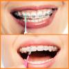Zopeal 250 Pieces Braces Flossers Interdental Brush for Cleaner Tooth Toothpick Dental Teeth Flossing Picks Head Oral Dental Hygiene Cleaning Tool Soft Cleaners(Cute Color) view 4