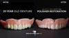 Bilistic Pro Series Denture Cleaner | Professional Denture Polisher for At-Home Use | Corded Variable Speed Cleaning Tool with Interchangeable Heads | Brighter Image Lab view 4