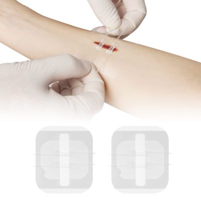 Zip Stitch Laceration Repair Without Stitches Butterfly Bandaids Quick Clot - Emergency Wound Closures Device 2 Pieces (Thin Film)