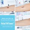 Zip Stitch Laceration Repair Without Stitches Butterfly Bandaids Quick Clot - Emergency Wound Closures Device 2 Pieces (Thin Film) view 2