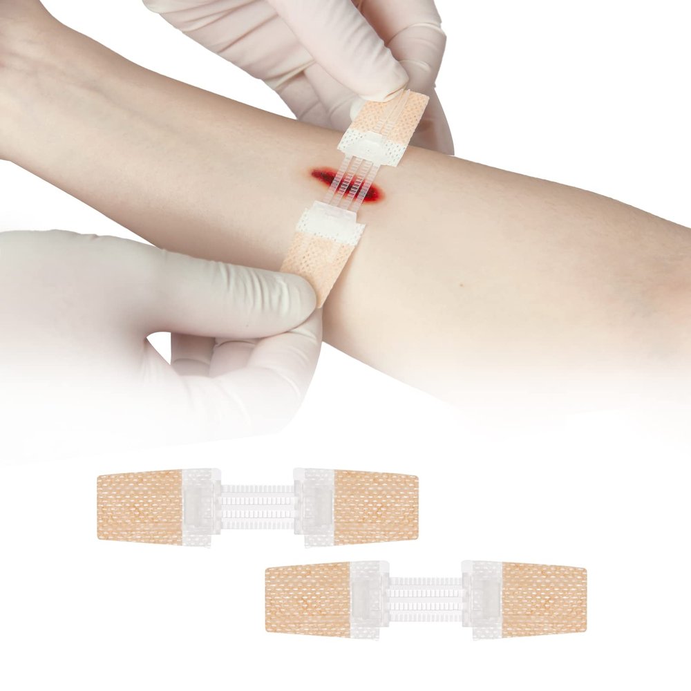 Zip Stitch Laceration Repair Without Stitches Butterfly Bandaids Quick Clot - Emergency Wound Closures Device 2 Pieces (Non-Woven Fabric)