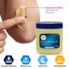 MED PRIDE 100% Pure White Petroleum Jelly, Skin Protectant, 8 oz, Unscented view 4