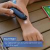Beurer BR90 Insect Sting and Bite Relief with Light, Chemical-Free Bug Bite Healer for Day and Night, Electronic Heat Device for After Mosquito Bites to Ease Itching and Swelling view 3