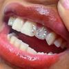 3pcs/Box Dental Tooth Gem Crystal Jewelry Acrylic Tooth Beauty Diamond Ornaments Tooth Deco Material Various Shape for Choose (Color : 3) view 1