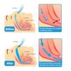 BANGBREK CARE Anti snoring Device, Snore Stopper, Silicone Magnetic Nose Clip, Comfortable & Reusable Nasal to Relieve Snore 4 PCS White view 3