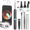 BEBIRD R1 Wax Removal Tool for Ear - Spade Ear Canal Cleaner with Camera 1080P Earscope, Wax Remove Ear Picker with Vari Replacement Tips, Camera with 6LED Light (R1+) view 1