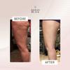 FasciaBlaster The ProBlaster Handheld by Ashley Black. Scientifcally Proven MyoFascial Tools. Gentle Massage with Effective Results. Releive Full Body Tension and Anti-Cellulite view 3