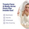 Boiron Acne Relief Kit for Blackheads, Oily Skins, Whiteheads on The Face and Body - 3 Count (240 Pellets) view 2