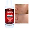 Skin Scars Silicon and Collagen Hydrolyzed Gel Resurfacing Skin Collagen Promoter For Indented Atrophic Rolling Face Scars By ALKA VITA view 2