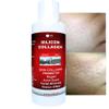 Skin Scars Silicon and Collagen Hydrolyzed Gel Resurfacing Skin Collagen Promoter For Indented Atrophic Rolling Face Scars By ALKA VITA view 4